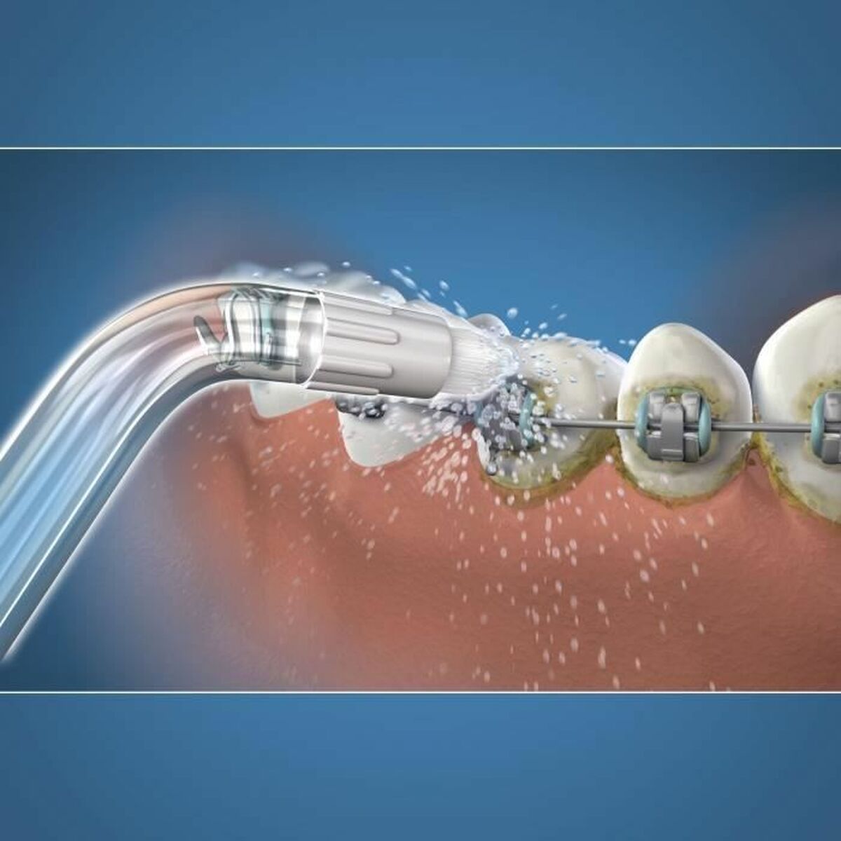 Reservehode Waterpik OD-100E